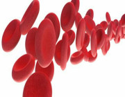 تعرف على أعراض ”سرطان الدم” الأكثر شيوعا !