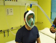 ابتكار أجهزة تنفس صناعي من أقنعة الغطس لمواجهة “كورونا”