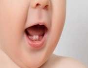 متى يبدأ الأطفال في فقدان الأسنان اللبنية؟ .. التفاصيل هنا !!