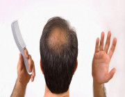 تعرف على أنواع الأضرار النفسية لتساقط الشعر عند الرجال .. التفاصيل هنا !!